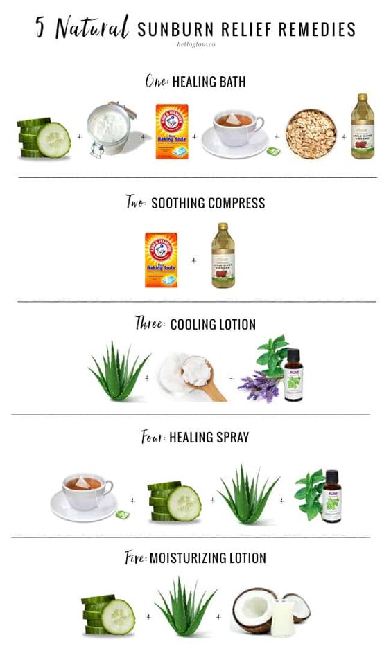 5 natural sunburn relief remedies