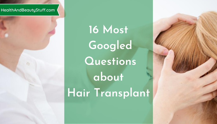 16 most googled questions about hair transplant