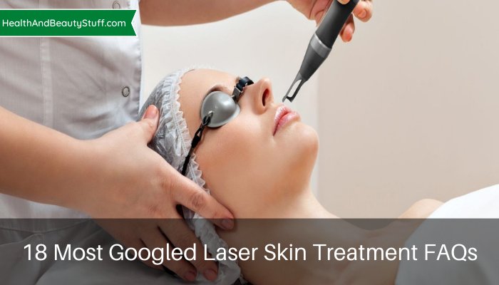Most Googled Laser Skin Treatment FAQs