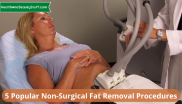 5 Popular Non-Surgical Fat Removal Procedures