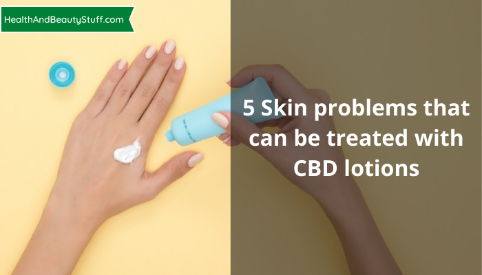5 Skin problems that can be treated with CBD lotions
