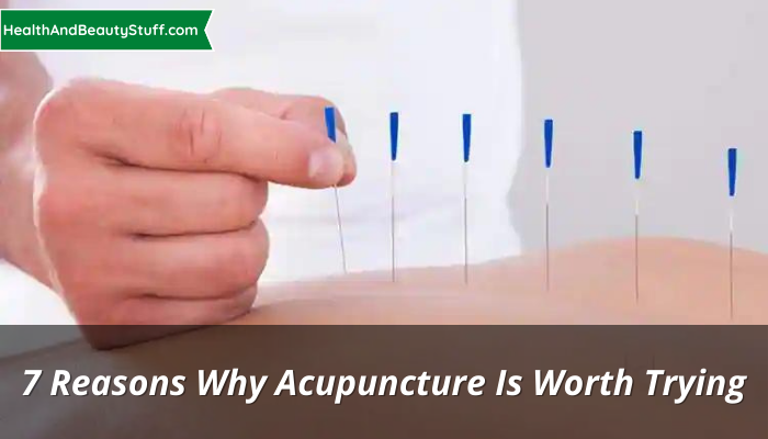 7 Reasons Why Acupuncture Is Worth Trying