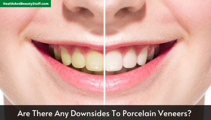 Are There Any Downsides To Porcelain Veneers 