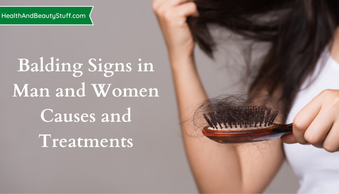 Balding Signs in Man and Women - Causes and Treatments