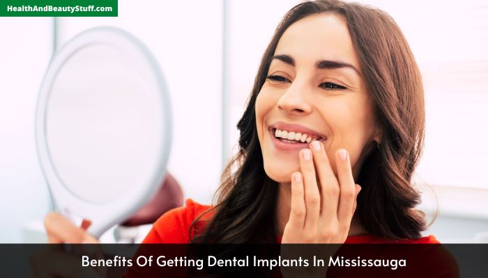 Benefits Of Getting Dental Implants In Mississauga