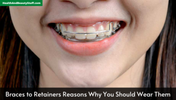 Braces to Retainers Reasons Why You Should Wear Them