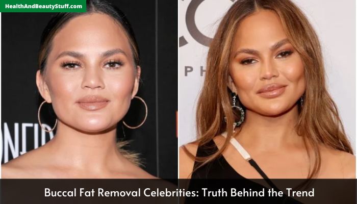 Buccal Fat Removal Celebrities: Truth Behind the Trend