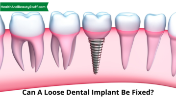 Can A Loose Dental Implant Be Fixed