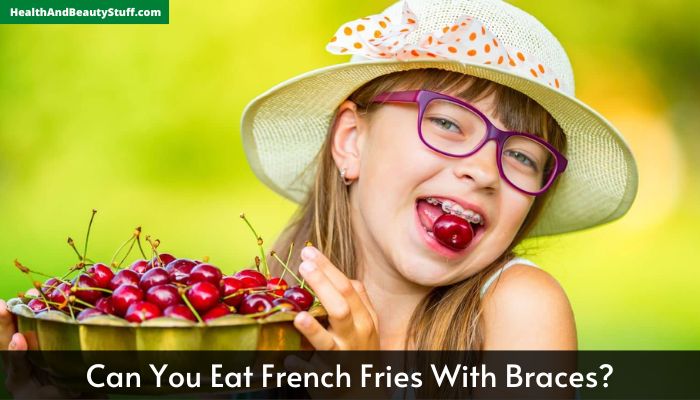 Can You Eat French Fries With Braces