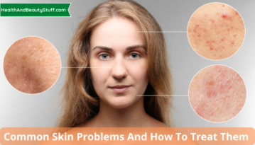 Common Skin Problems And How To Treat Them