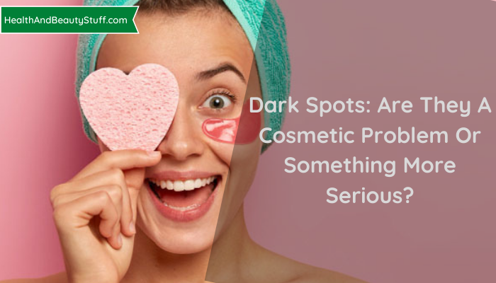 Dark Spots: Are They A Cosmetic Problem Or Something More Serious?