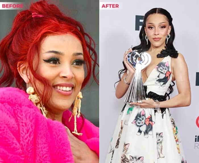 Doja Cat weight loss before and after Photo Comparison 