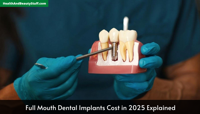 Full Mouth Dental Implants Cost in 2025 Explained