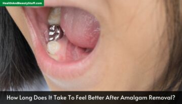 How Long Does It Take To Feel Better After Amalgam Removal