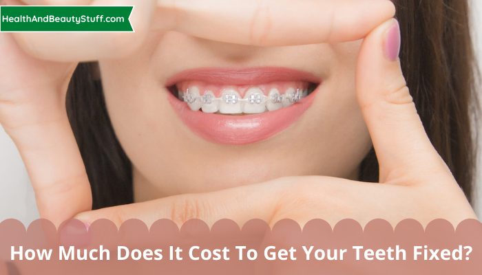 How Much Does It Cost To Get Your Teeth Fixed