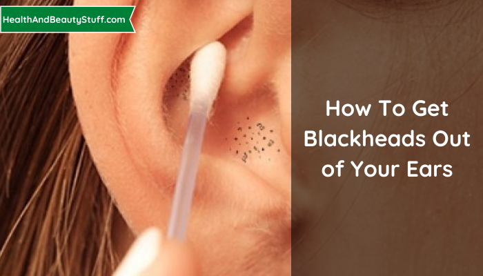 How To Get Blackheads Out of Your Ears