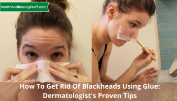How To Get Rid Of Blackheads Using Glue Dermatologist's Proven Tips