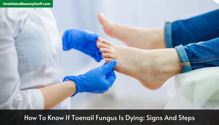 How To Know If Toenail Fungus Is Dying Signs And Steps