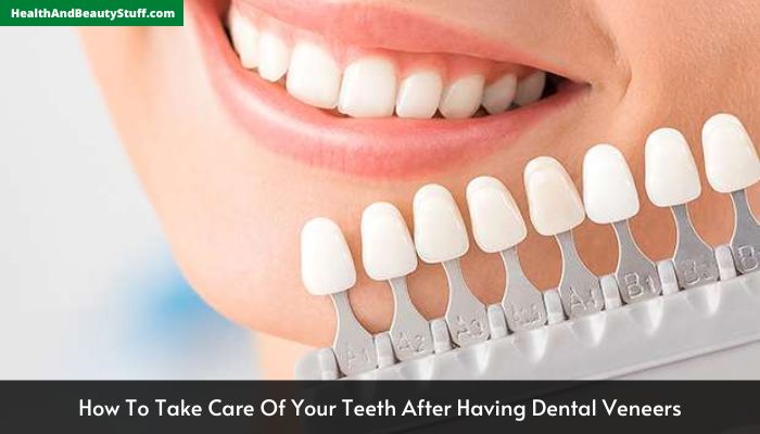 How To Take Care Of Your Teeth After Having Dental Veneers