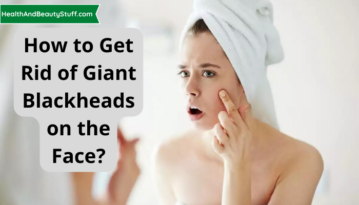 How to Get Rid of Giant Blackheads on the Face