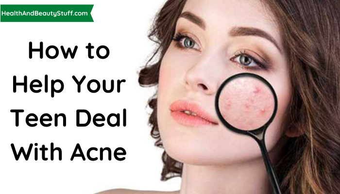 How to help your teen deal with acne (2)