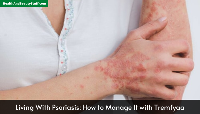 Living With Psoriasis How to Manage It with Tremfyaa