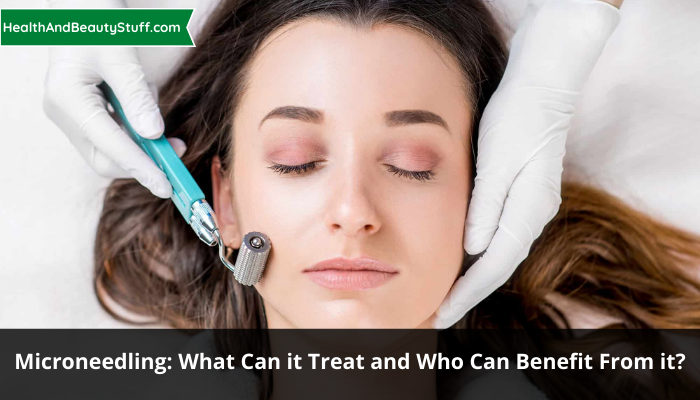 Microneedling What can it treat and who can benefit from it