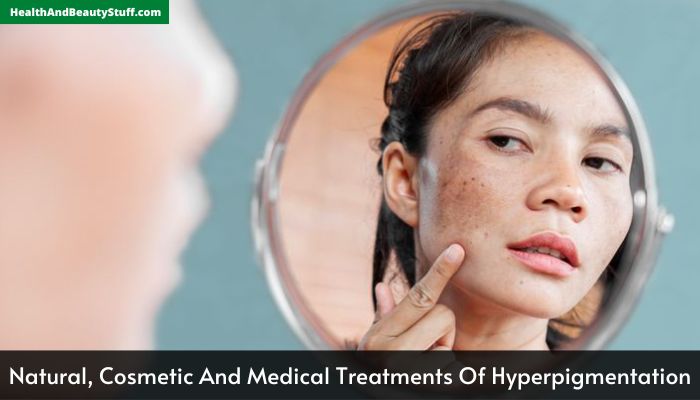 Natural, Cosmetic And Medical Treatments Of Hyperpigmentation