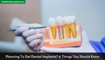 Planning To Get Dental Implants 6 Things You Should Know