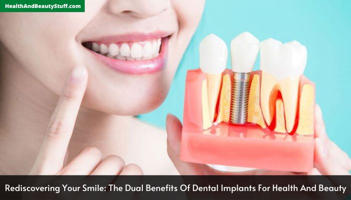 Rediscovering Your Smile The Dual Benefits Of Dental Implants For Health And Beauty