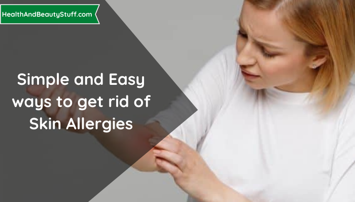 Simple and Easy ways to get rid of Skin Allergies