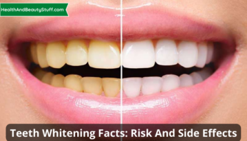 Teeth Whitening Facts Risk And Side Effects