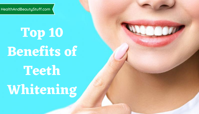Top 10 Benefits of Teeth Whitening