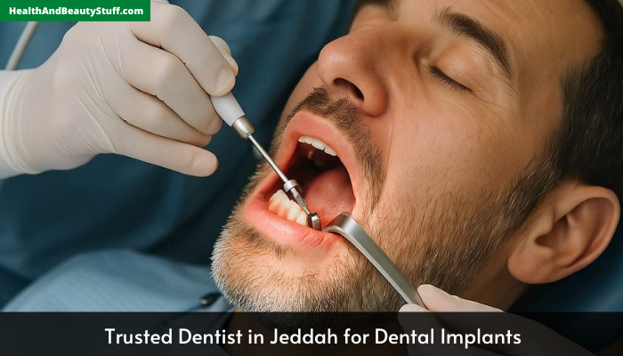 Trusted Dentist in Jeddah for Dental Implants