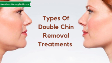 Types of Double Chin Removal Treatments