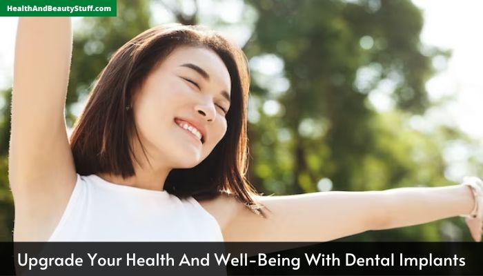 Upgrade Your Health And Well-Being With Dental Implants
