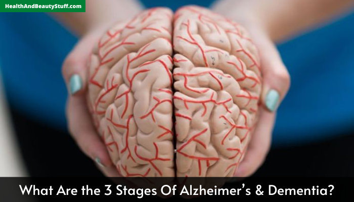 What Are the 3 Stages of Alzheimer’s & Dementia