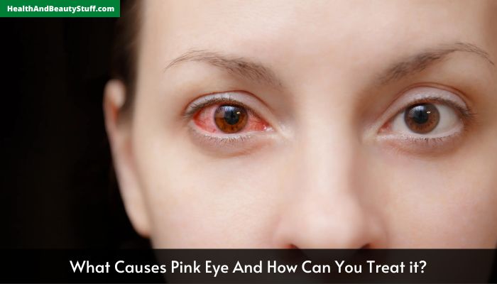 What Causes Pink Eye And How Can You Treat it