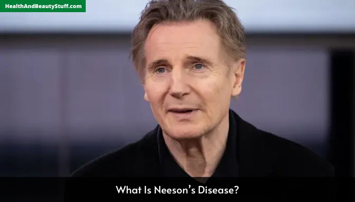 What Is Neeson’s Disease
