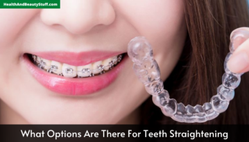 What Options Are There For Teeth Straightening