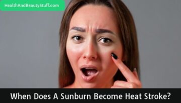 When Does a Sunburn Become Heat Stroke