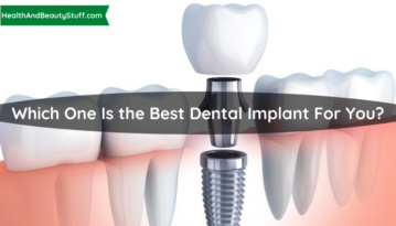 Which One Is the Best Dental Implant For You