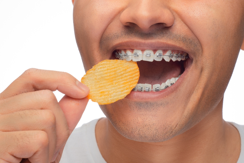 Tips for Eating Fries Safely with Braces