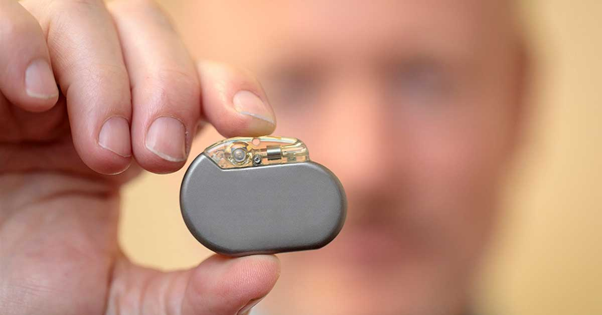 The Benefits Of Vagus Nerve Stimulation