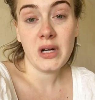 Adele Swollen Face