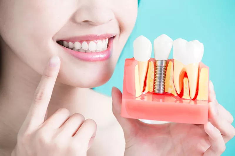 Dental Implants Function And Look Like Natural Teeth