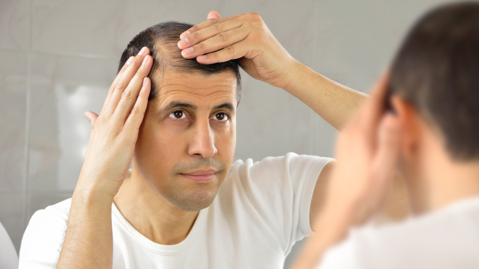 Hair Loss and Balding Due to Stimulant Use