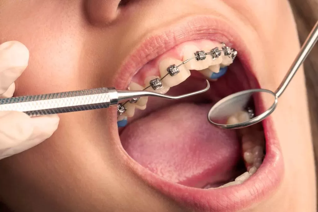 Consider orthodontic procedures