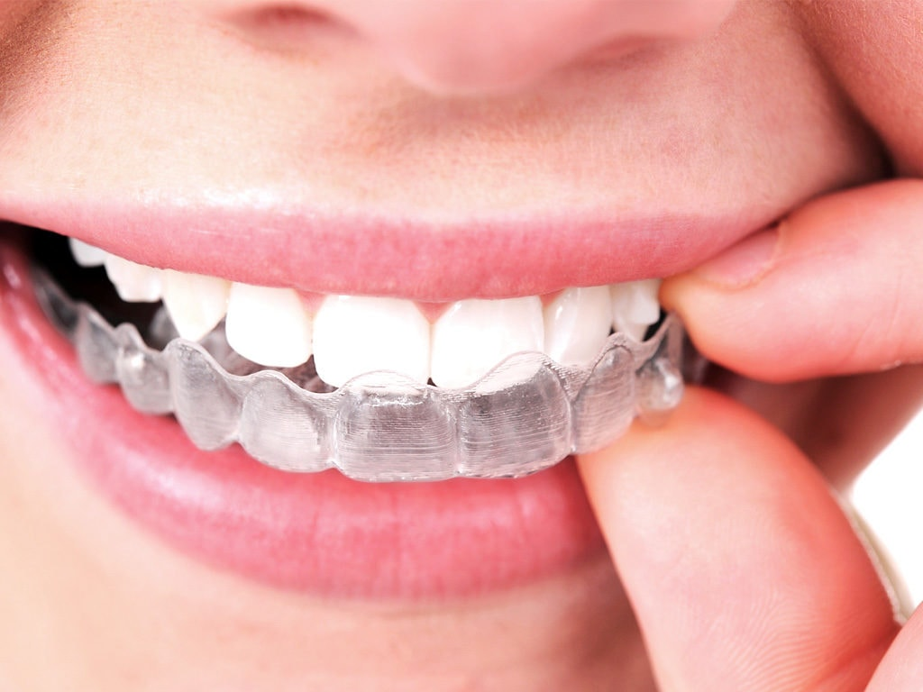 How Do Dentists Straighten Teeth?