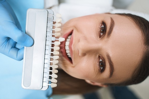 Tips for Taking Care of Your Teeth After Having Veneers